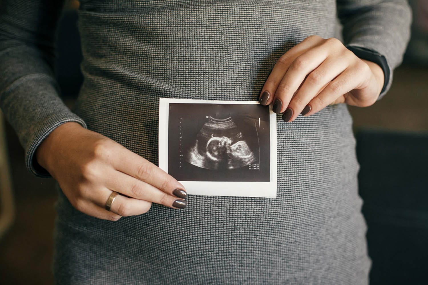 0 11 Haftalik Gebelik Fetal Gelisim ve Annedeki Degisimler 0 11 Haftalik Gebelik Fetal Gelisim ve Annedeki Degisimler