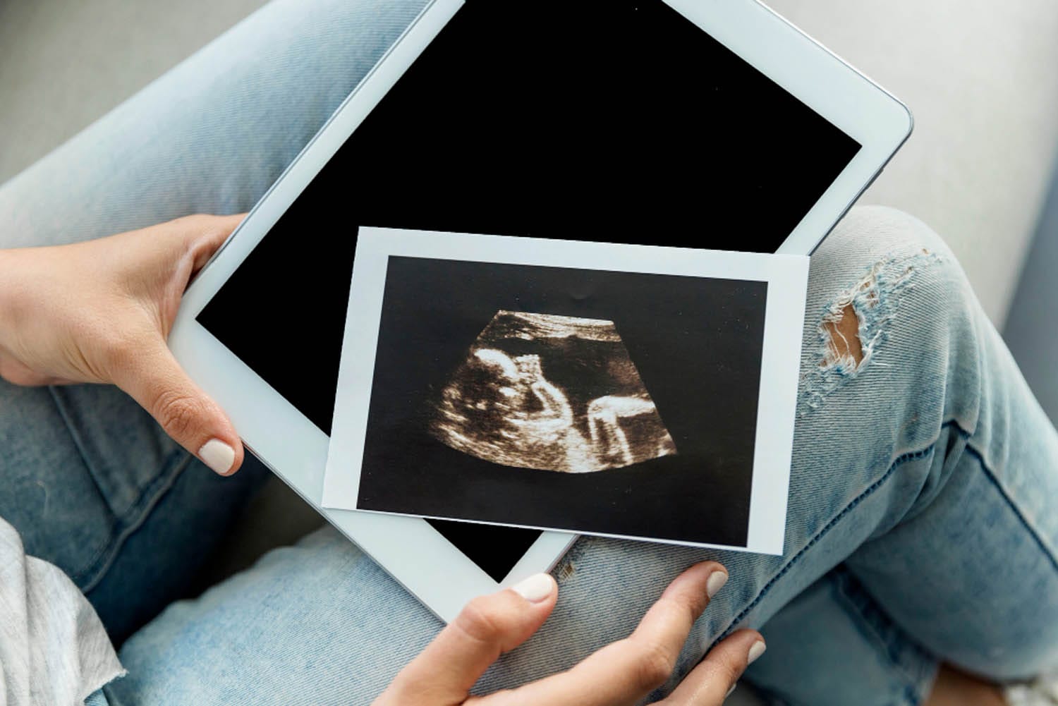 1 Hamileligin 8 Haftasinda Anne Adayini Bekleyen Hormonal Surprizler
